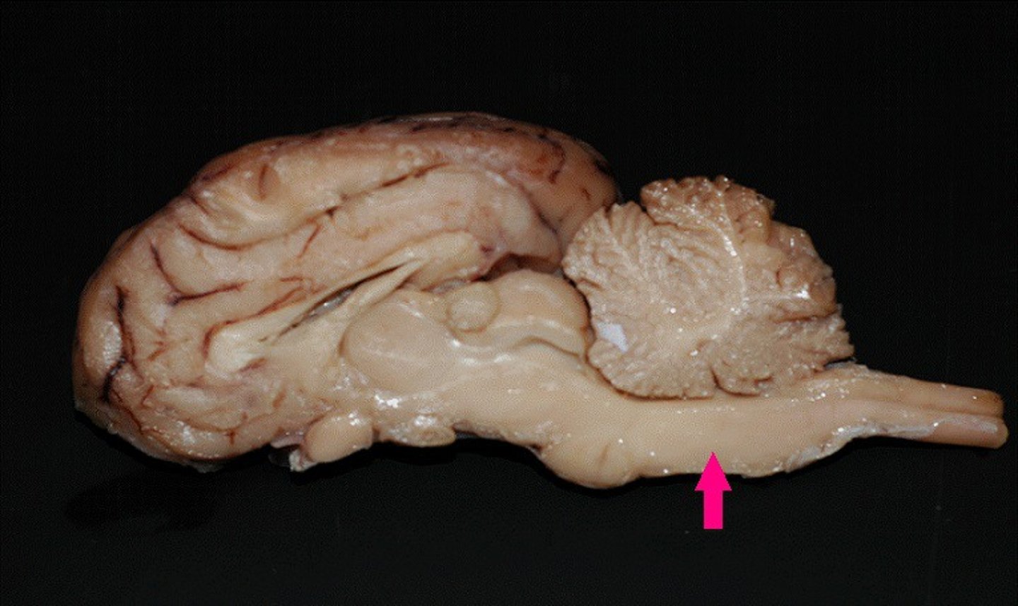 <p>-midbrain, pons, medulla oblongata</p><p>-caudal to cerebellum</p><p>-rostral to spinal cord</p>