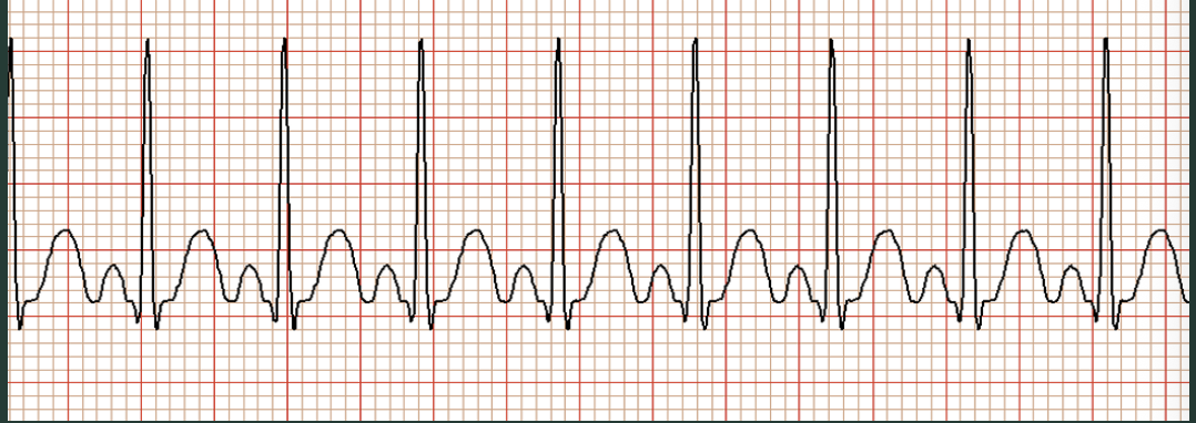 <p>ID this rhythm?</p>