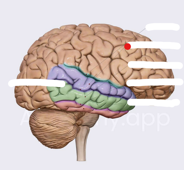 <p>Identify the structure pinned</p>