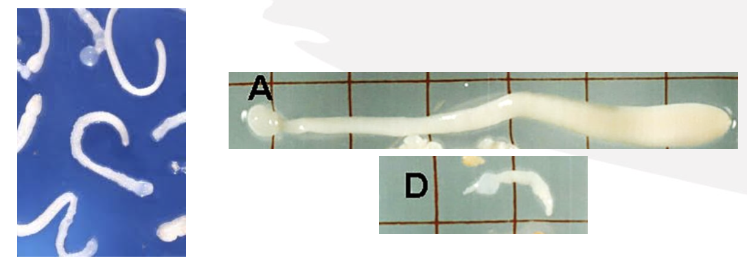 <p>What type of metacestode stage is this? </p>