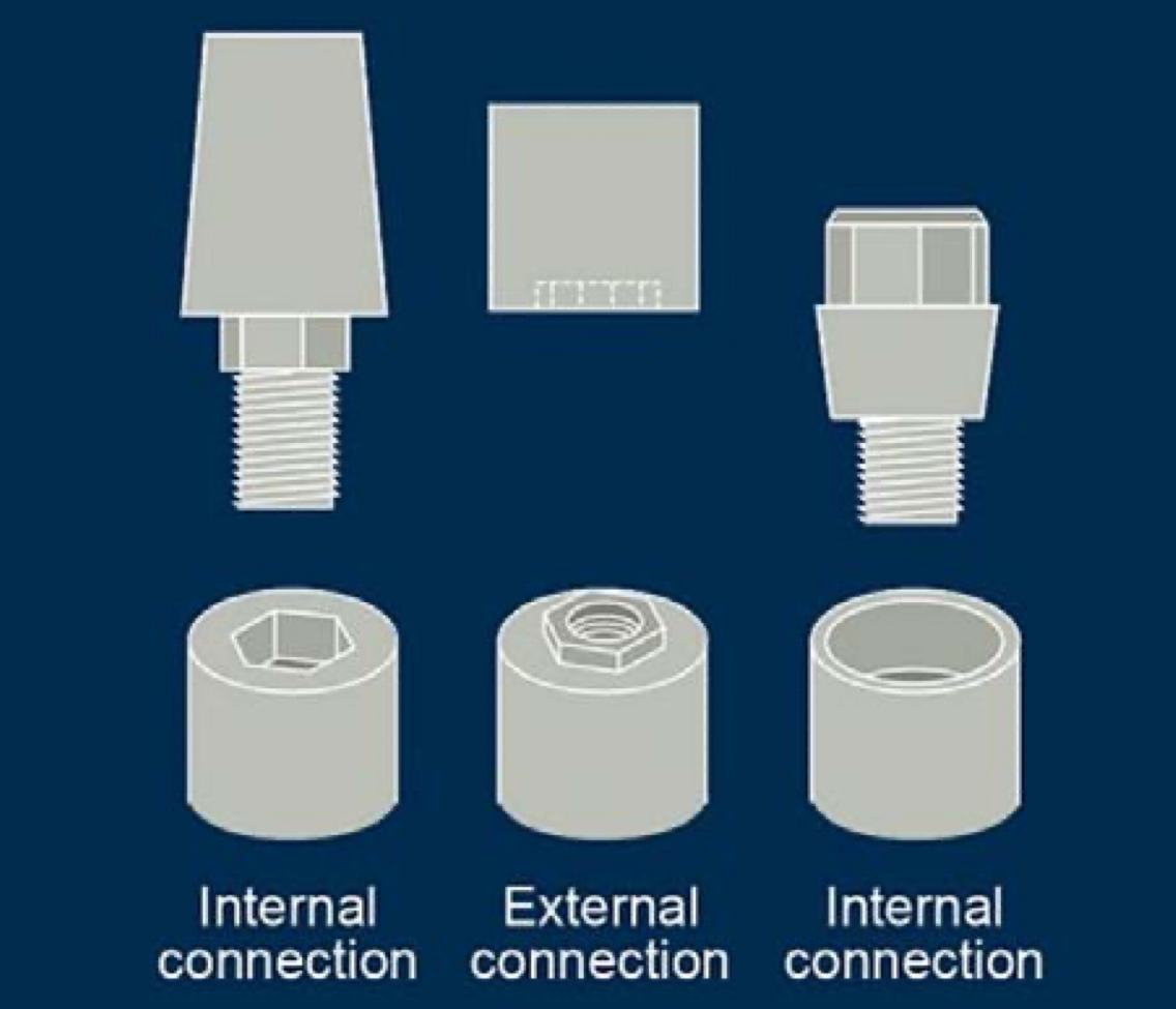 <p>Abutment connection - external, internal, morse taper, conical connections</p>