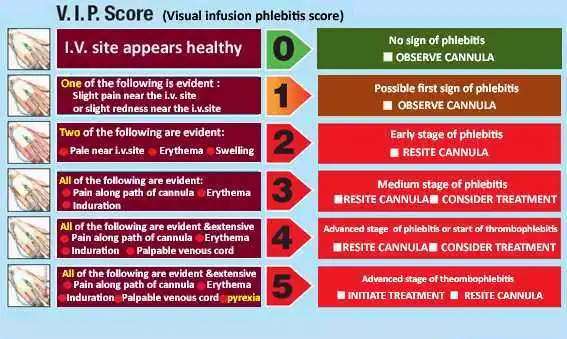 <p>Visual infusion phlebitis</p>