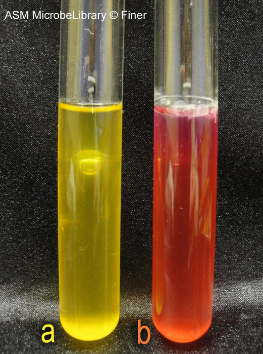 <p>A student observes a phenol red <em>mannitol broth with </em>Staphylococcus aureus sps. that is yellow and cloudy (like in tube a), with a large gas bubble floating at the top of the inverted Durham tube. How would this be recorded in Table 9-6?</p><p>a. Growth: Y, Acid: N, Gas: N</p><p>b. Growth: Y, Acid: N, Gas: Y</p><p>c. Growth: N, Acid: Y, Gas: Y</p><p>d. Growth: Y, Acid: Y, Gas: Y</p>