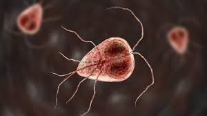 <p>Giardiasis</p>