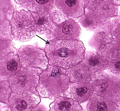 <p>What phase of mitosis is indicative of the cell at the arrow?</p>