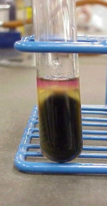 <p><strong><u>Sulfide </u></strong>Indole Motility tests for?</p>