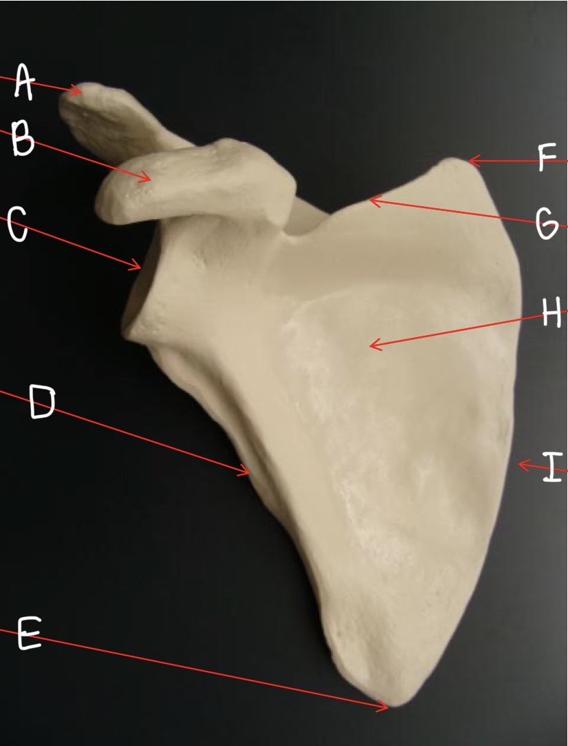 <p>What bone is this? (Name left or right, the anatomical view, and A-I)</p>
