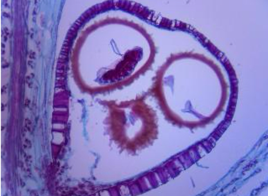 <p>The larger spore-producing structures in the club moss Selaginella.</p>