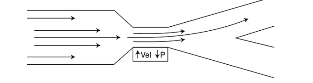 <p>describes how fluid follows a curved surface after a constriction in a tube</p><p>After constriction, pressure ↑ and velocity ↓ at different points</p><p>Flow will prefer route with lower pressure</p><p></p>