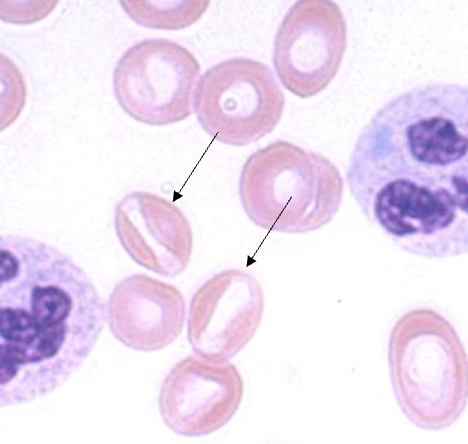 <p>name the type of RBC</p>