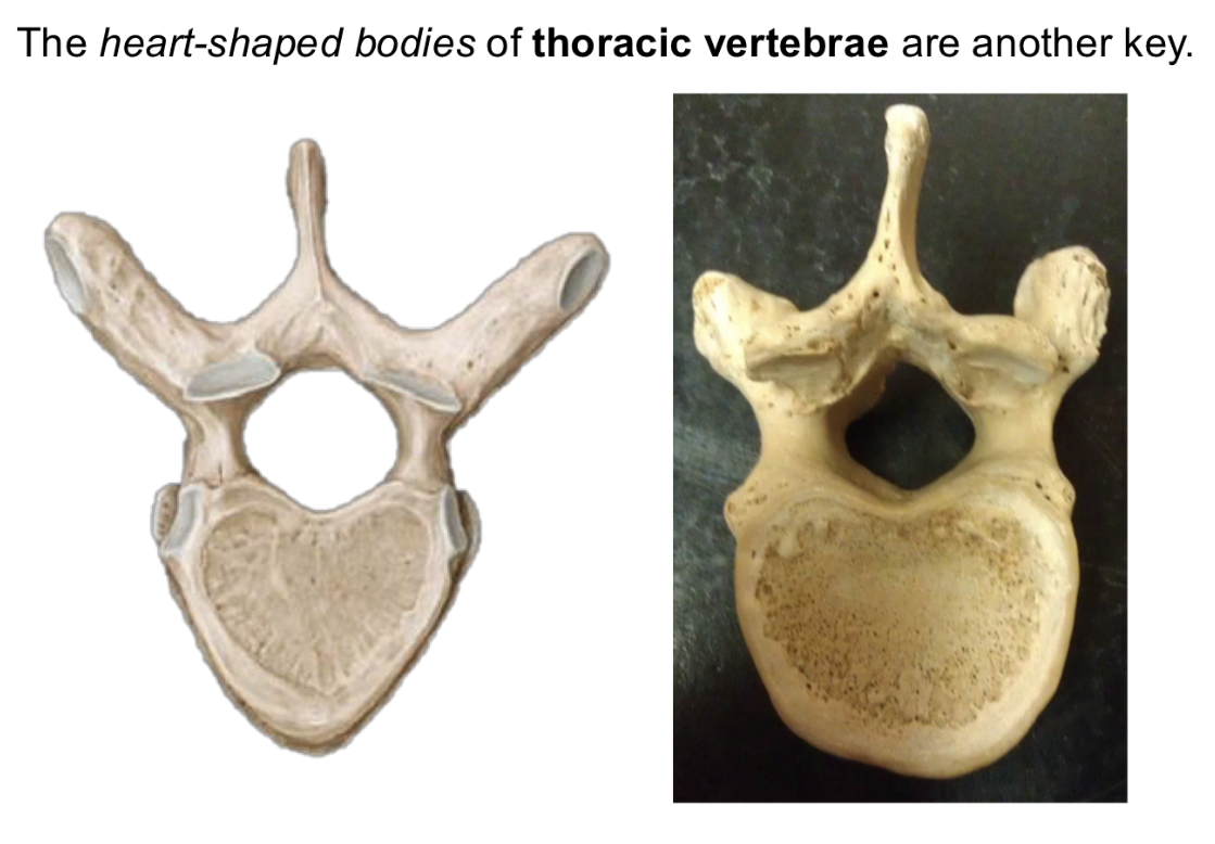 <p>Thoracic Vertebrae <strong>Types of vertebrae</strong></p>