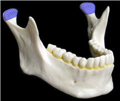 <p>a part of the mandible</p>