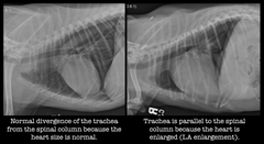 <p>The only pathologic process that causes the trachea to be elevated from its normal position (diverging from the spine) is cardiomegaly.</p><p>TRUE OR FALSE</p>