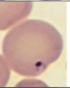 <p>RBC parasite</p>