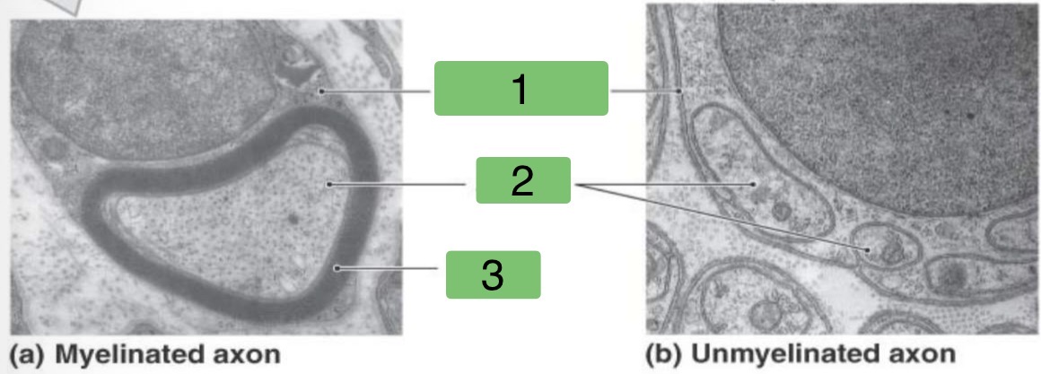 <p>Identify the parts of the different Axons</p>
