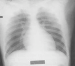 <p>identify the pathology</p>