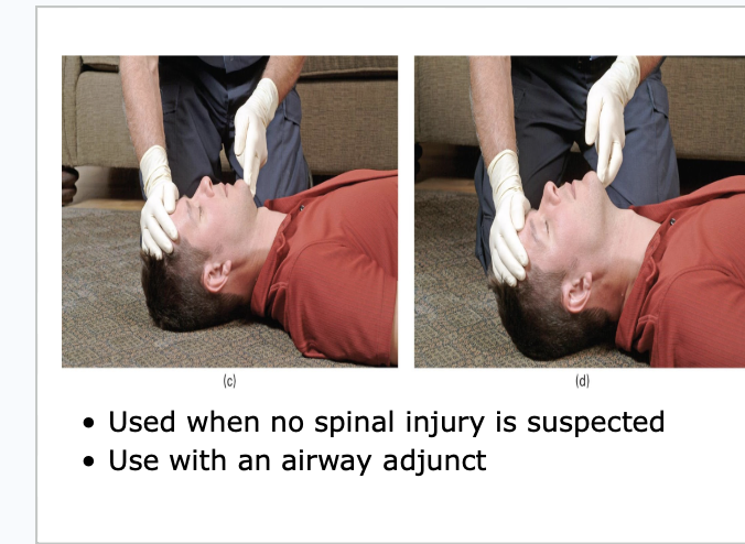 <ul><li><p><span style="background-color: transparent;">Opening the airway</span></p><ul><li><p><span style="background-color: transparent;">Manual maneuvers</span></p><ul><li><p><span style="background-color: transparent;"><em>Once open- maintain open</em></span></p></li></ul></li><li><p><span style="background-color: transparent;">Suction</span></p><ul><li><p><span style="background-color: transparent;">Rigid and soft</span></p></li></ul></li><li><p><span style="background-color: transparent;">Mechanical airways</span></p><ul><li><p><span style="background-color: transparent;">Oral and Nasopharyngeal&nbsp;</span></p></li></ul></li></ul></li></ul><p></p>