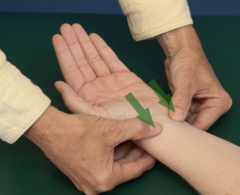 <p>Compress radial/ulnar arteries, open/close hand, release one artery; identifies vascular compromise.</p>