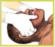 <p>Jaw Thrust</p>