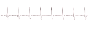 <p class="Paragraph SCXW42739986 BCX8" style="text-align: left;"><span style="line-height: 20.85px;">Causes: Severe heart disease: CAD, MI, myocarditis, cardiomyopathy </span></p><p class="Paragraph SCXW42739986 BCX8" style="text-align: left;"><span style="line-height: 20.85px;">Drugs: Digoxin, B-adrenergic blockers, calcium channel blockers </span></p><p class="Paragraph SCXW42739986 BCX8" style="text-align: left;"><span style="line-height: 20.85px;">Tx: If symptomatic, transcutaneous pacemaker until a temporary transvenous pacemaker can be inserted </span></p><p class="Paragraph SCXW42739986 BCX8" style="text-align: left;"><span style="line-height: 20.85px;">Drugs (e.g., atropine, dopamine, epinephrine): Temporary measure to increase HR and support BP until temporary pacing is initiated. Permanent pacemaker as soon as possible </span></p>