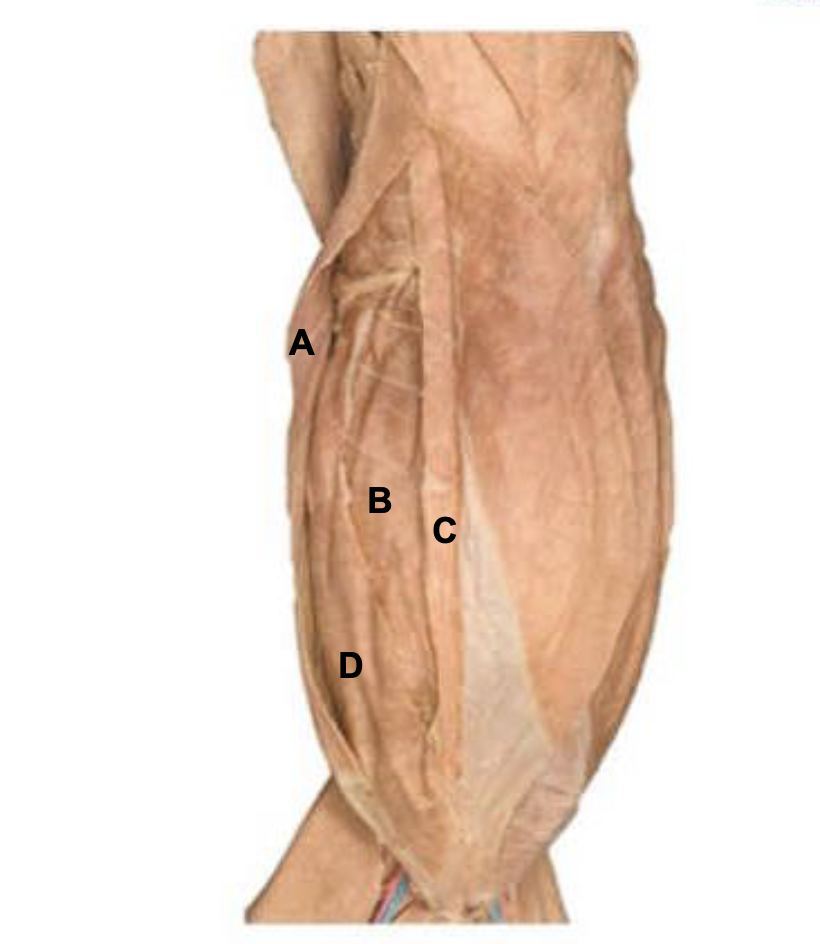 <p>C</p>