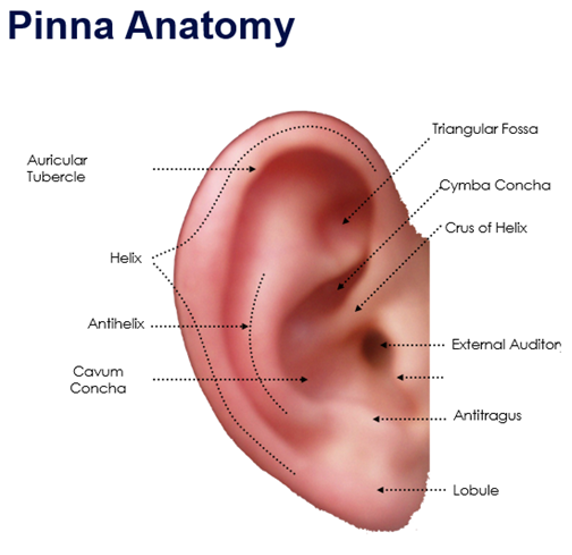 <p>label missing part</p>