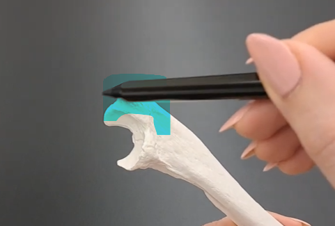 <p>ulna </p>