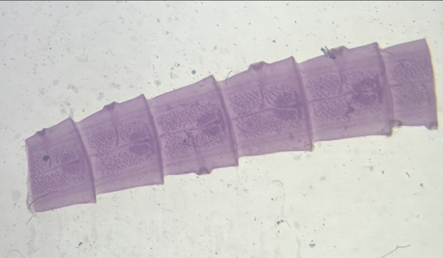 <p>What phylum and class is this?</p>