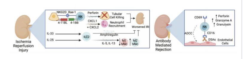 <ul><li><p><span style="background-color: transparent; font-family: "Open Sans", sans-serif;">About one third of transplants are from living donors</span></p><ul><li><p><span style="background-color: transparent; font-family: "Open Sans", sans-serif;">Better immediate kidney function &amp; less risk of rejection from living donor</span></p></li></ul></li><li><p><span style="background-color: transparent; font-family: "Open Sans", sans-serif;"><strong>Circulating recipient NK cells</strong></span></p><ul><li><p><span style="background-color: transparent; font-family: "Open Sans", sans-serif;">Recruit neutrophils &amp; kill renal tubule cells → exacerbates ischemia-reperfusion injury</span></p></li><li><p><span style="background-color: transparent; font-family: "Open Sans", sans-serif;">Kill graft vascular cells via ADCC (donor-specific antibodies)</span></p></li></ul></li><li><p><span style="background-color: transparent; font-family: "Open Sans", sans-serif;"><strong>ILC2s</strong></span></p><ul><li><p><span style="background-color: transparent; font-family: "Open Sans", sans-serif;">Stimulate cell growth &amp; survival → minimizes ischemia-reperfusion injury</span></p></li><li><p><span style="background-color: transparent; font-family: "Open Sans", sans-serif;">Promote type 2 (wound healing) macrophage activity&nbsp;</span></p></li></ul></li><li><p><span style="background-color: transparent; font-family: "Open Sans", sans-serif;"><strong>γδ T cells</strong></span></p><ul><li><p><span style="background-color: transparent; font-family: "Open Sans", sans-serif;">Recruit αꞵ T cells &amp; cause renal tubule damage</span></p></li></ul></li></ul><p></p>