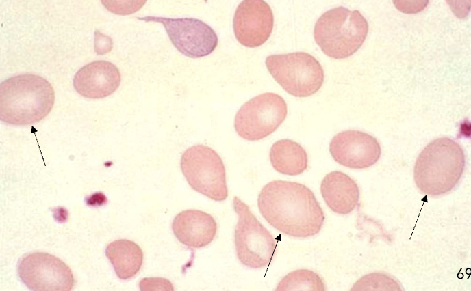<p>name the type of RBC</p>