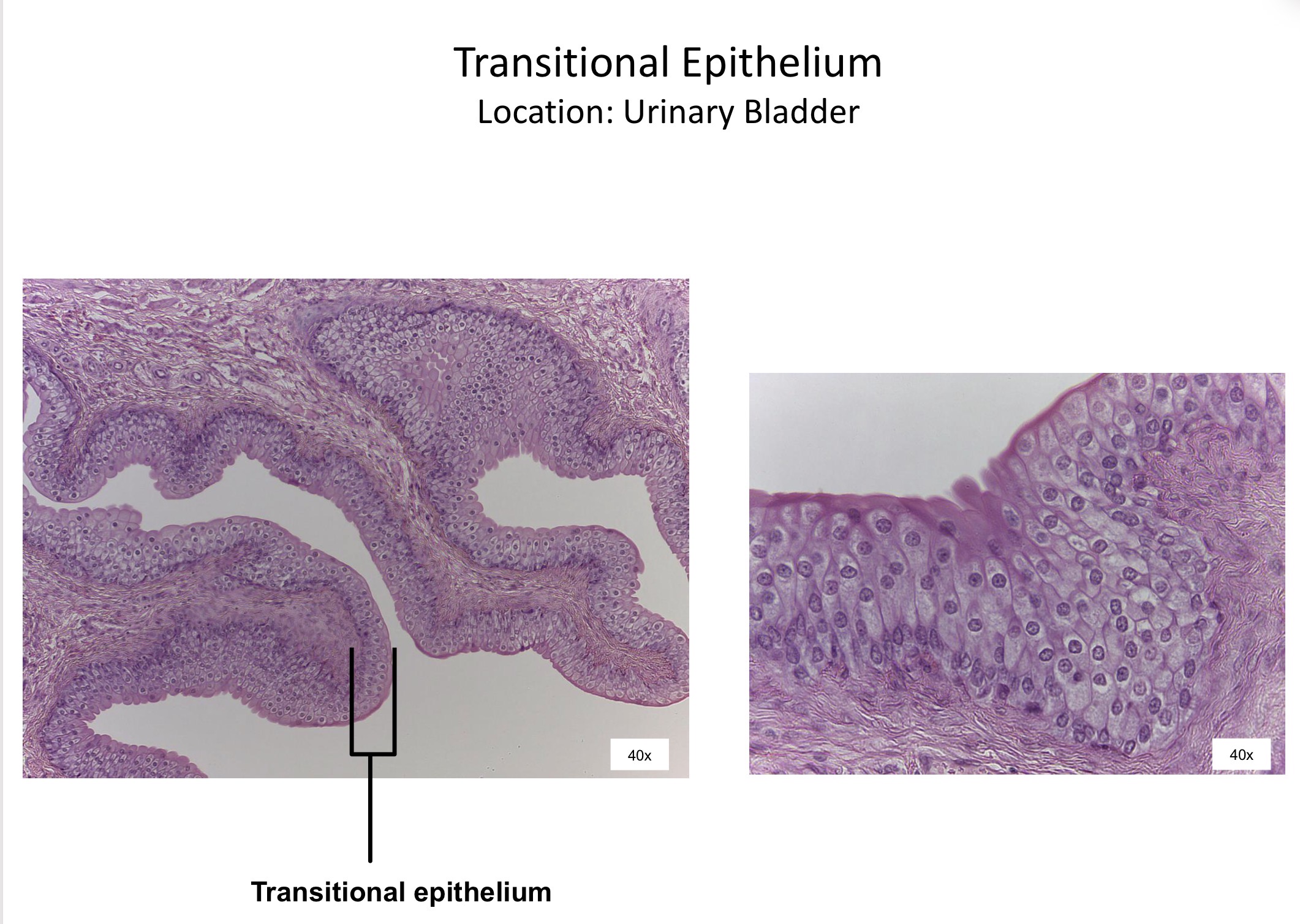 <ol><li><p>Transitional epithelium </p></li></ol><p></p>