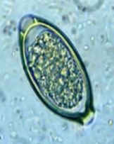 <p>type of egg, and what nematode</p>