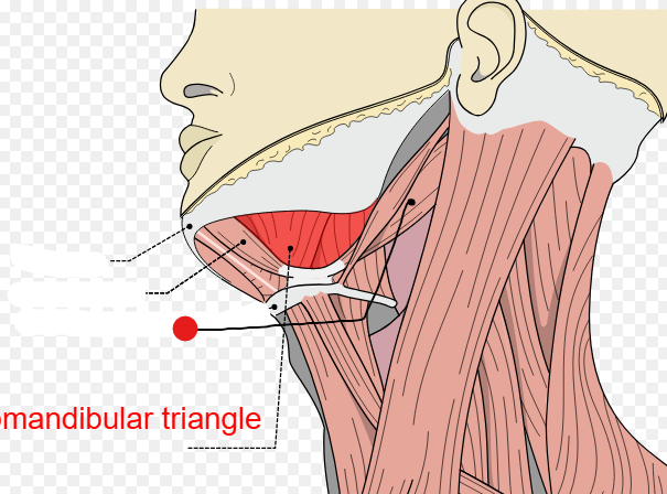 <p>Identify the structure pinned</p>