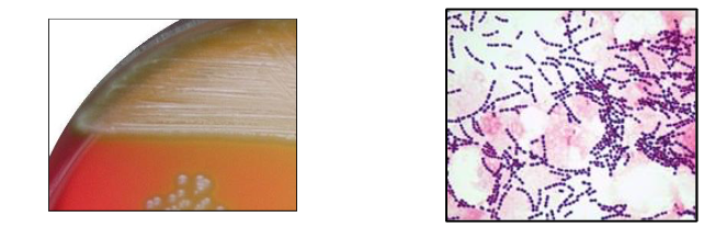 <p>The alpha-haemolytic streptococci</p>