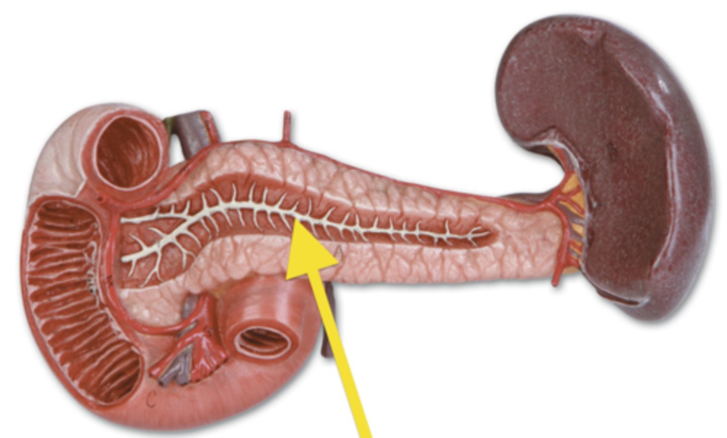 <p>pancreatitis</p>
