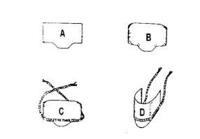 <p>which matrix band is this?</p>