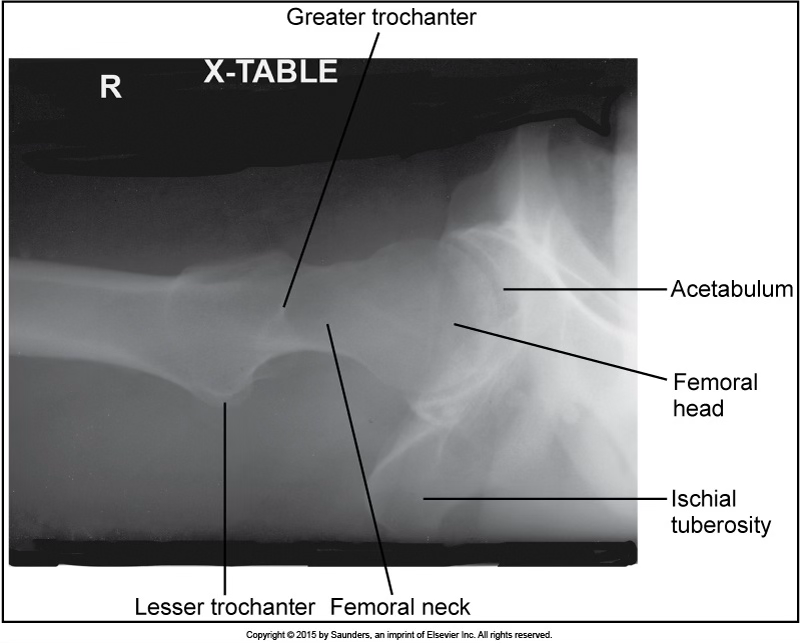 <p>hip axiolateral (danelius-miller/x-table)</p>
