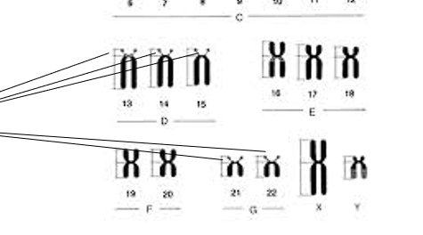 <ul><li><p>Human chromosomes that have “arms”</p><ul><li><p>Short arm (p)</p></li><li><p>Long arm (q)</p></li></ul></li><li><p>Short arms of acrocentric chromosomes contains REPETITIVE sequences for rRNA</p></li></ul><p></p>