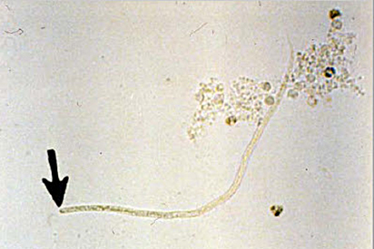<p>Identify the parasite</p>