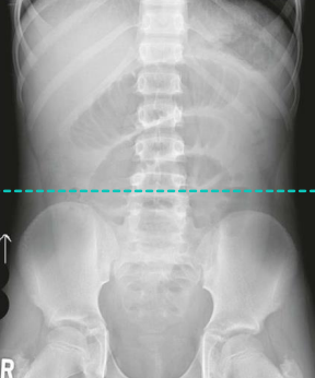 <p>Upright Abdomen: Is this Image Good?</p>