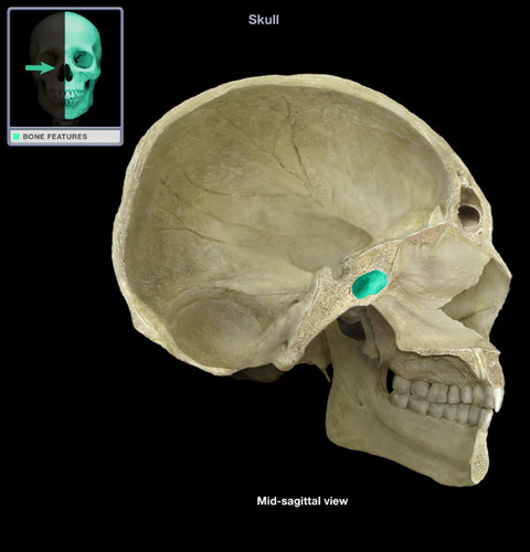 term image