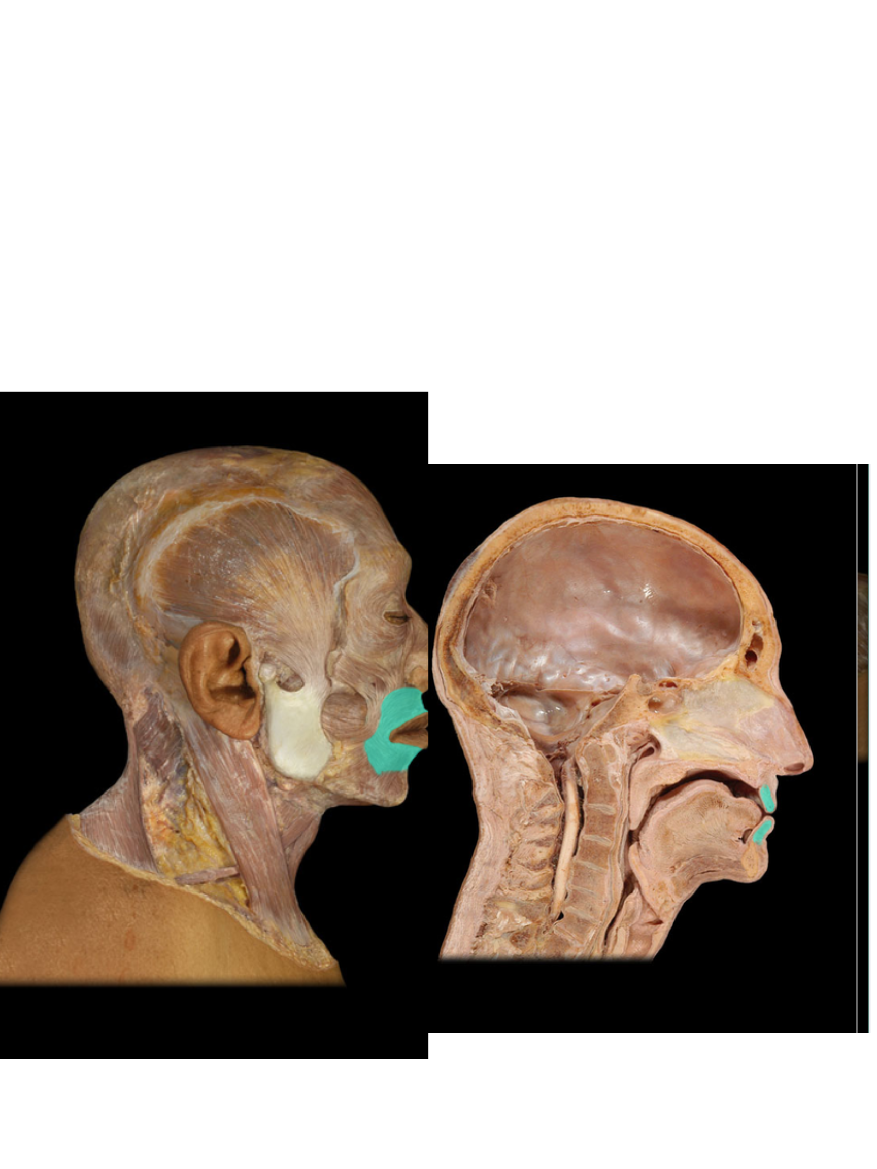 <p>Orbicularis oris m.</p>