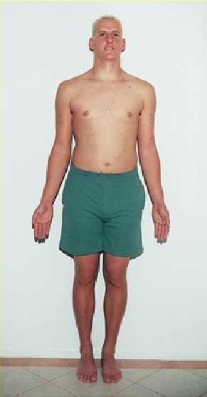 <p>describe the palms and toes in anatomical position</p>