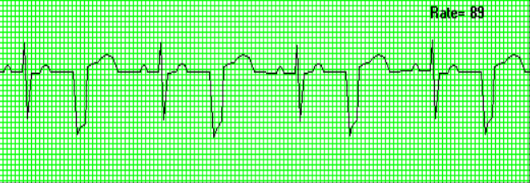 <p>what waveform is this</p>