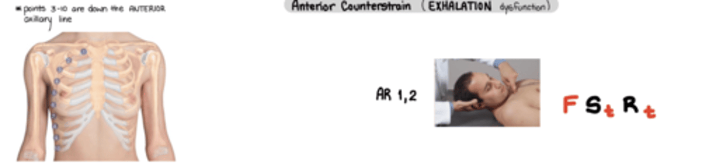 <p>anterior = exhalation sd</p><p>AR 1,2 = FStRt</p><p>AR 3-10 = FStRt</p><ul><li><p>ASS! - anterior same side -> pt mermaid legs same side as TP</p></li><li><p>Arm back = Rt</p></li><li><p>Physician moves leg out = St</p></li><li><p>physician leg on opposite side</p></li></ul><p></p>