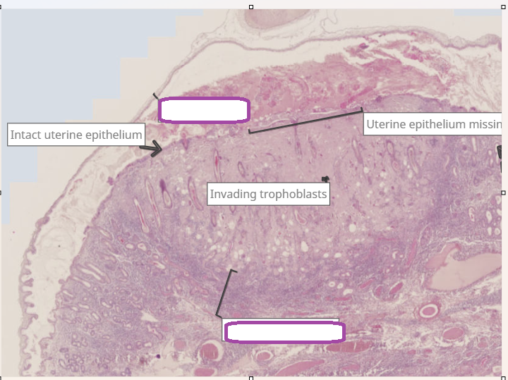 <p>this is an endometrial cup</p>