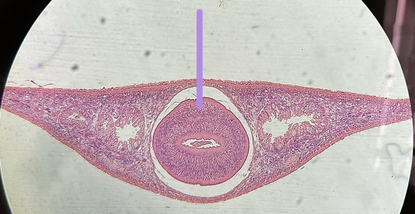 <p>What is this structure </p>