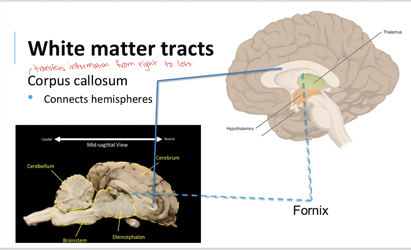 <p>A large white matter tract connecting the left and right cerebral hemispheres.</p>