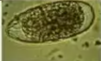 <p>Identify</p>