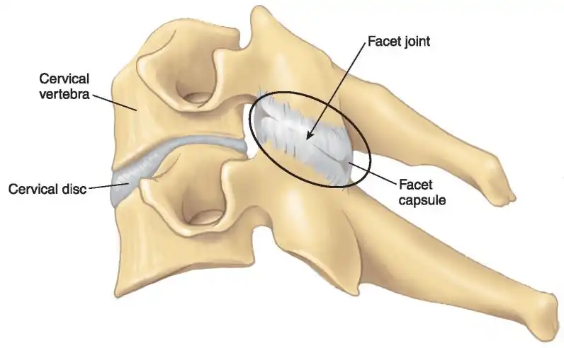 <p>facet</p>